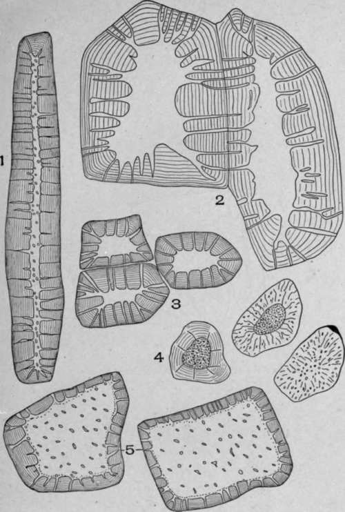 Porous and Striated Stone Cells.
