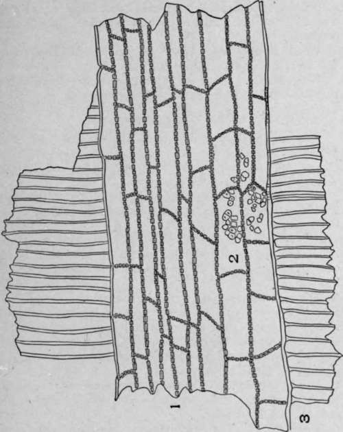 Radial Section of Quassia Wood {Picraena excelsa [Sw.] Lindl.).