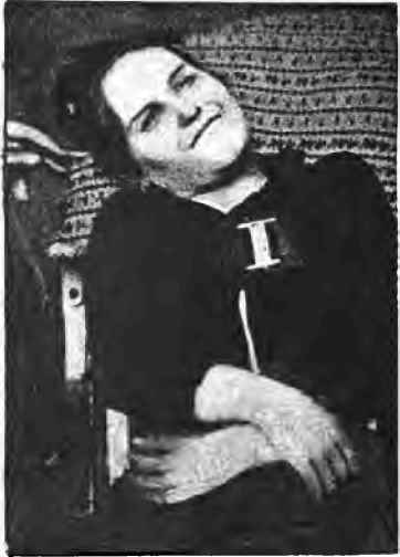 Esther is influenced by a tube containing sulphate of strychnine.