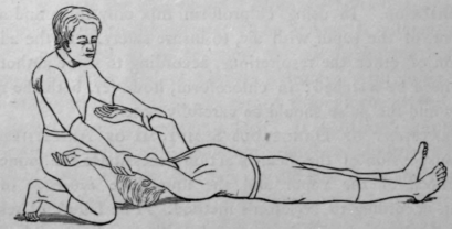 Treatment Of Dangerous Symptoms Of Anaesthesia 610
