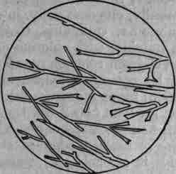Fig. 389. Cinchonine sulphate with KSCy: microscopic crystals