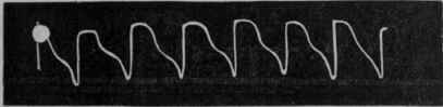 Amyl Nitris B and U S P Nitrite of Amyl C5H11NO2 243