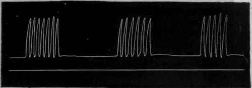 Fig. 104. Periodic rhythm of the heart, the pulsations occurring in groups separated by intervals of complete quiescence.