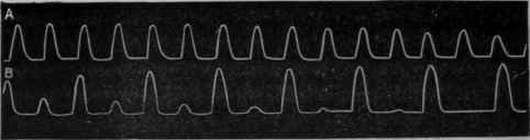 Fig. 105.   Tracing of the pulsations of a ventricle separated from the auricles by section at the auriculo ventricular groove. After Ranvier, Lecons, 1877 78.