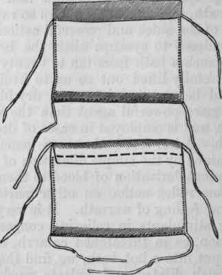 Fig. 157. The upper figure represents the bag empty; the lower one the bag filled and sewn up.