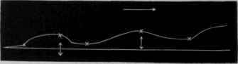 Fig. 35.   Shows the action on muscle of caustic potash, 1 in 2,500, twice renewed for 13 minutes, succeeded by the action of lactic acid, 1 in 500, for 18 minutes, and this by the action of caustic potash for 17.
