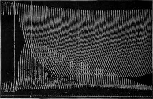 Hypothesis Regarding The Action Of The Vagus 160