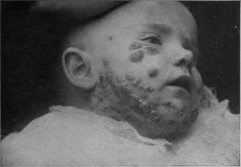 Fig. 41.