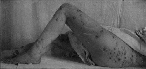 Fig. 42.
