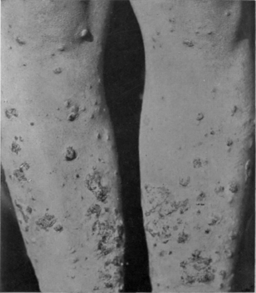 Fig. 43.