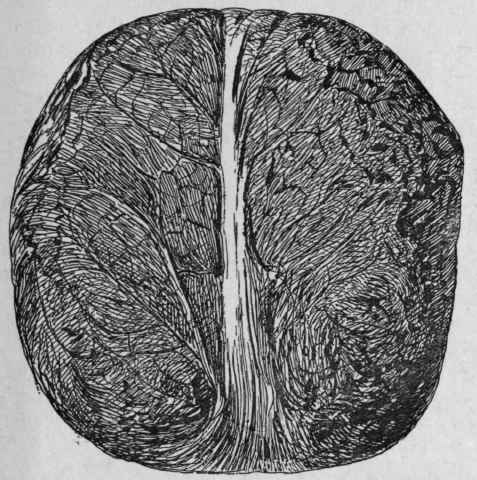 Fig. 234. Turkey Opium. Slightly reduced. {Pharmaceutical Journal.)