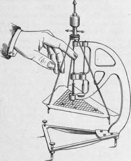 Professor Fisher's Diet Indicator.
