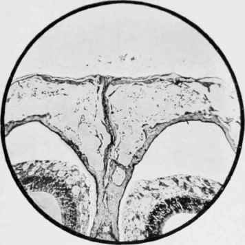 From a vertical section of the Cranium of a Rat set.