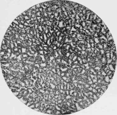 The normal appearance of the Thyroid Gland of a Rat fed on the ordinary laboratory diet.