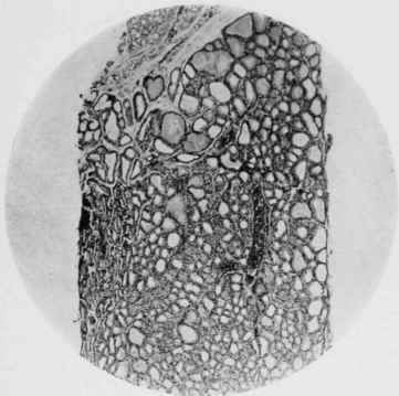 Thyroid Ghind of Wild Rat.