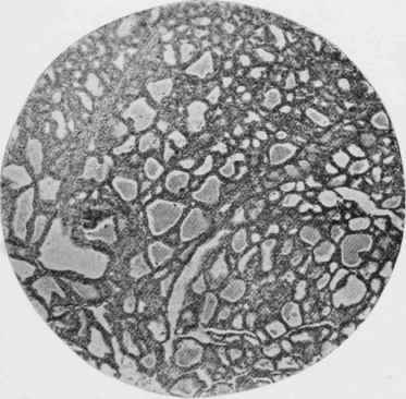 Thyroid Gland of a Rat of same age as Fig. 27. after being fed for six weeks on an catmeal diet.