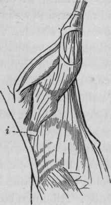 Shows changed position of muscles.