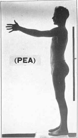 Pea, Feb. 2, 1918.