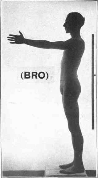 Photograph of Bro, Feb. 2, 1918.