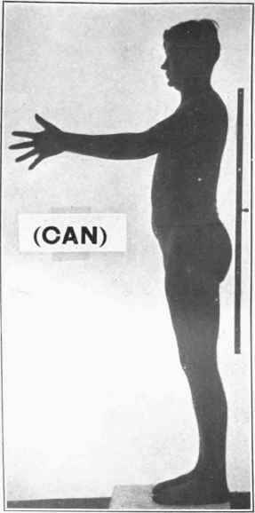 Photograph of Can. Sept. 29,1917. Beginning of experiment.