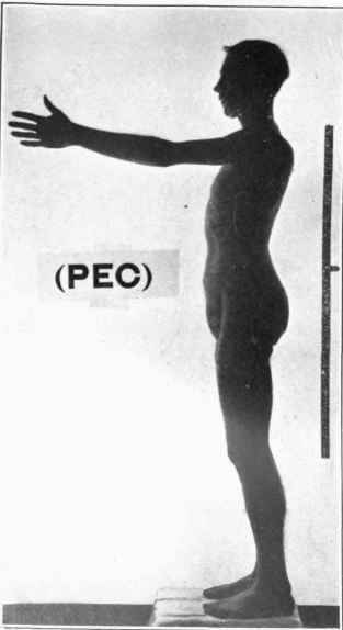 Photograph of Pec, Feb 2, 1918.