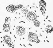 Cells of the yeast plant in process of budding, between which are some bacteria.