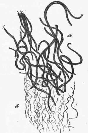 Coarse (a) and fine {b) yellow elastic fibres after treatment with, strong acetic acid (Cadiat).