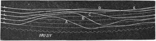 Curves drawn by the same muscle in different stages of fatigue.