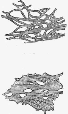 Elastic membrane from inner coat of aorta, and, below, meshwork of elastic fibres from a yellow ligament.