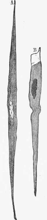 Muscle cells, showing different condition 0f the protoplasm of the cell and nucleus.