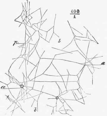 Reticulum of Fibrin Threads after staining has made them visible.
