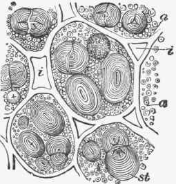 Section of Pea, showing starch and aleurone granules imbedded in the protoplasm of the cells.