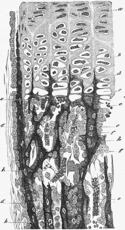 Section through ossifying cartilage and young bone.