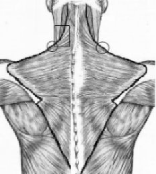 The Trapezius Muscles 80