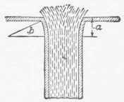 The Contracted Vein 70