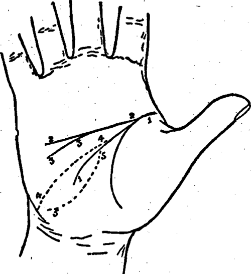 Plate II. The Line Of Head Joined To The Line Of Life And Its Terminations.