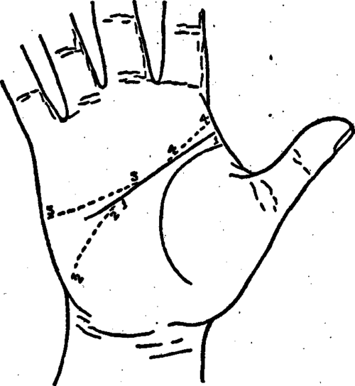 Plate III. The Line Of Head Separated From The Line Of Life.