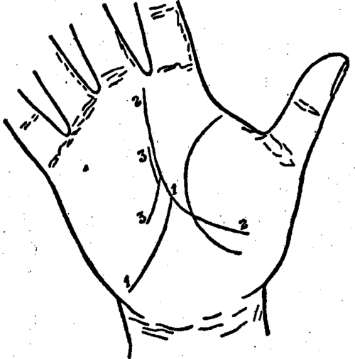 Plate XIII. The Line Of Destiny And Its Modifications.
