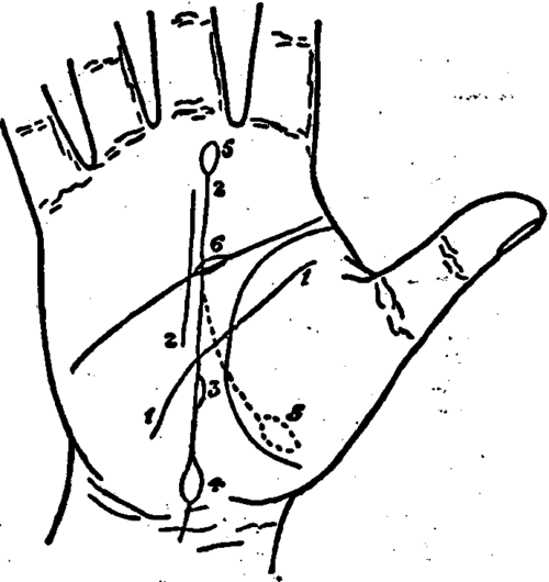 Plate XIV. The Line Of Destiny, Islands, And Other Signs.