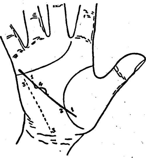 Plate XIX. The Line Of Health.