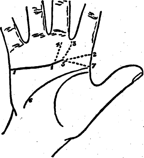 Plate XVI. The Line Of Heart And Its Variations.