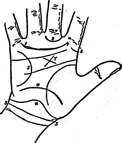Plate XX. The Girdle Of Venus, The Ring Of Saturn, The Three Bracelets, The Line Of Intuition And The Via Lasciva.