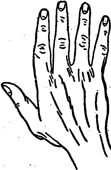 The Conic Or Artistic Hand.