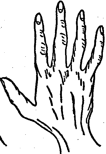The Psychic Or Idealistic Hand.