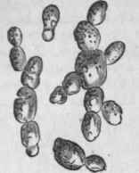 Saccharomyces cerevisisB   Yeast of sedimentary beer, budding, magnified 400 diameters.