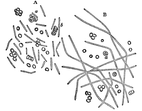 Fig. 7. Bacillus anthracis.