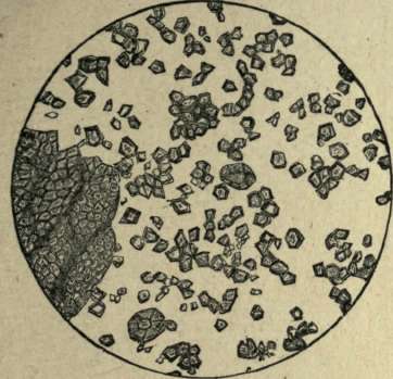 RICE STARCH UNDER MICROSCOPE.