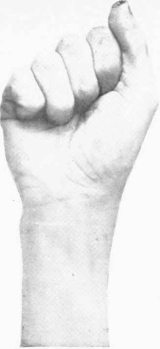 Fig. 38. Straight position.